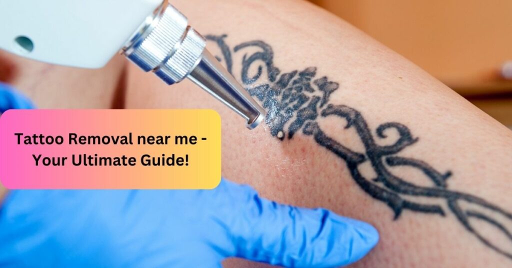 Tattoo Removal near me - Your Ultimate Guide!